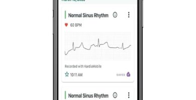 KardiaMobile device on table, highlighting heart health benefits and game-changing features.